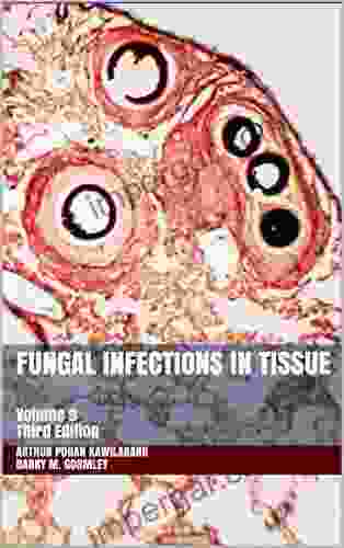 Fungal Infections in Tissue: Volume 9