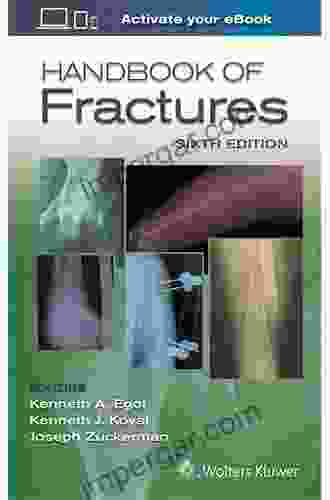 Handbook of Fractures Vishram Singh